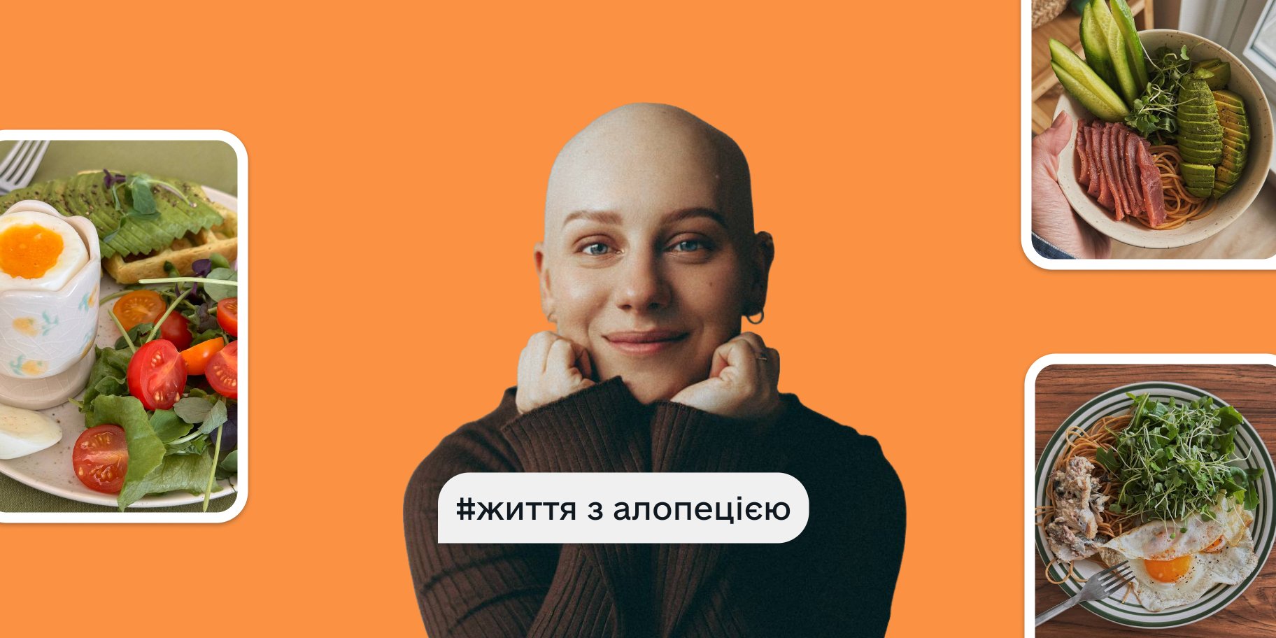 Життязалопецією