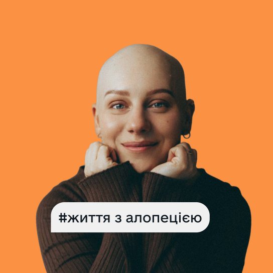 Життязалопецією