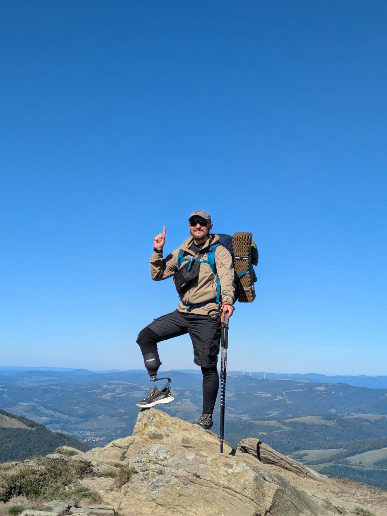 Станіслав розповів про реабілітацію після ампутації