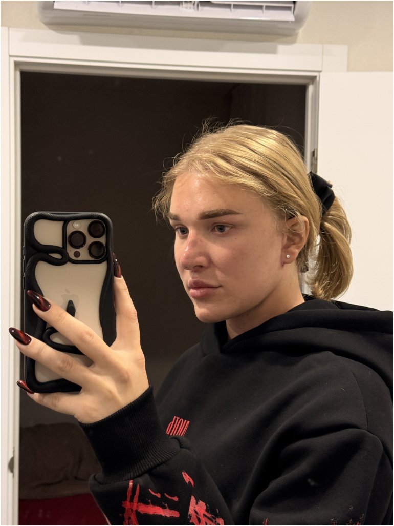 Емілію під час переходу підтримували близькі та&nbsp;ком’юніті